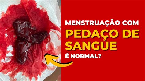 sangue preto na menstruação-1